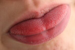 Votre langue est enflée ? Voici les différentes raisons…