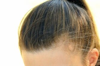 sante Découvrez 6 signes qui vous informent sur la santé de vos cheveux 6 signes