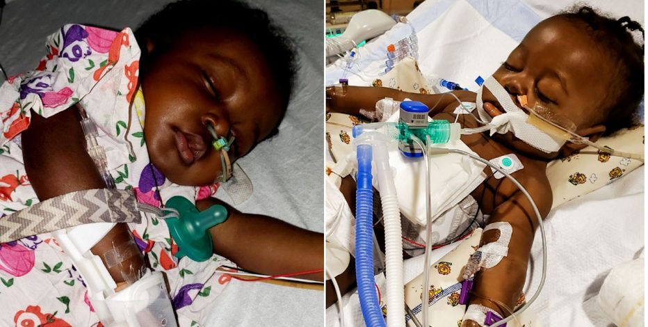 baby transplant Ce bébé célèbre son 1e anniversaire après avoir survécu au Covid-19 et fait une greffe foie