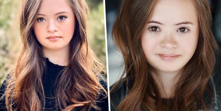 girl down syndrome becomes successful model e1610960410544