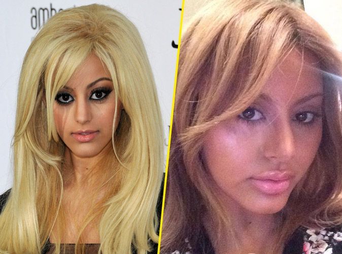 Photos Zahia Accro a la chirurgie Ses fans s inquietent face a son etonnante metamorphose Découvrez ces stars françaises avant et après la chirurgie esthétique