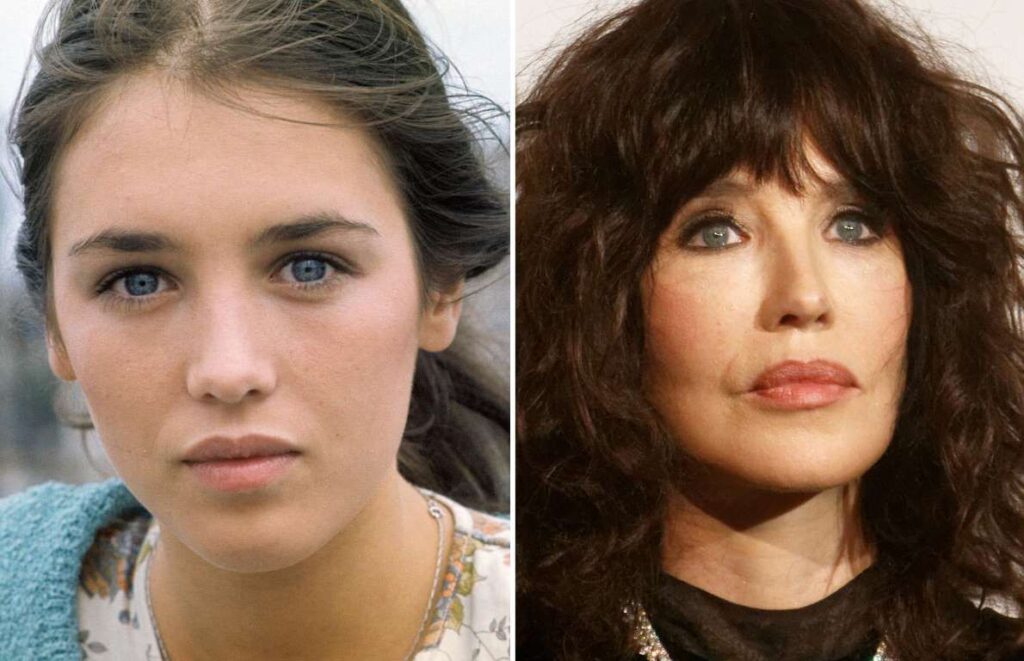 Découvrez ces stars françaises avant et après la chirurgie esthétique