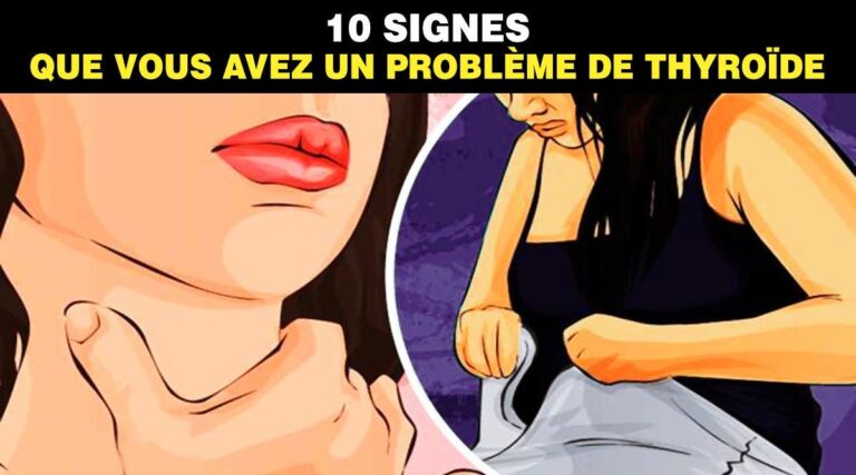 10 signes que vous avez un probleme de thyroide