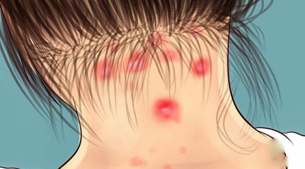 42 symptomes de la Fibromyalgie 1 1200×667 1 42 symptomes de la Fibromyalgie 1 1200x667 1
