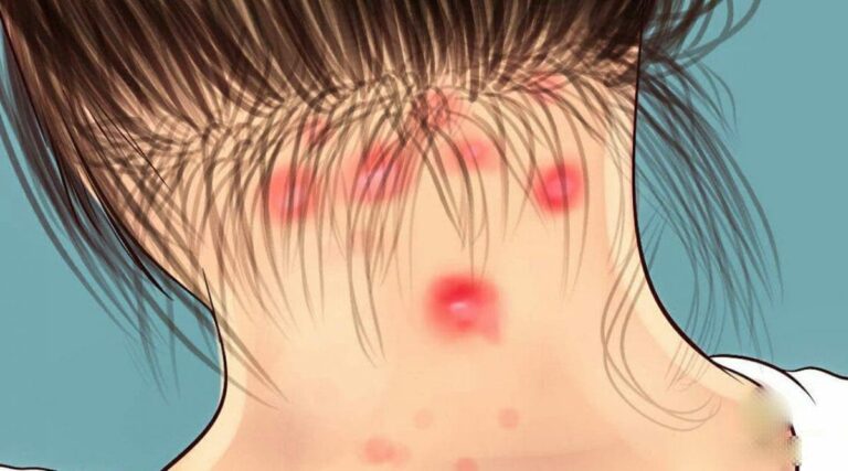 42 symptomes de la Fibromyalgie 1 1200x667 1