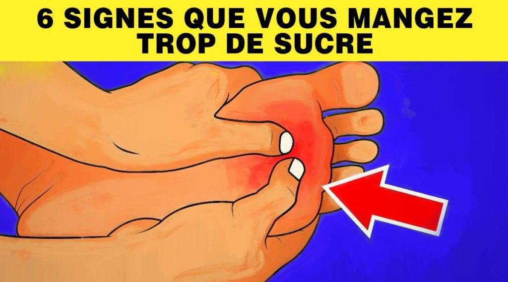 6 signes que vous mangez trop de sucre 6 signes que vous mangez trop de sucre