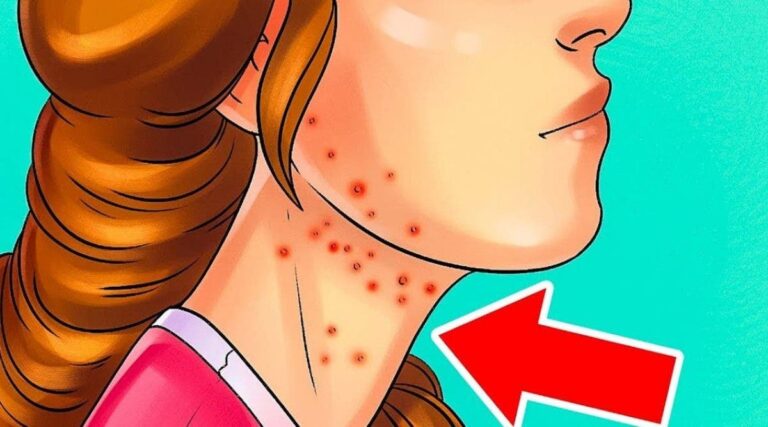 7 signes que vous mangez trop de sucre et vous risquez davoir le diabete1 1 1200x667 1