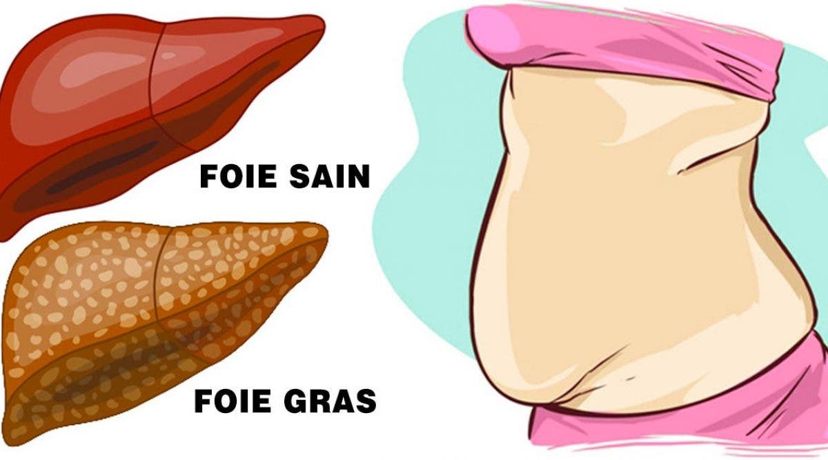 8 signes dalerte indiquant que votre foie est plein de toxines et vous fait grossir2 8 signes d'alerte indiquant que votre foie est plein de toxines et vous fait grossir