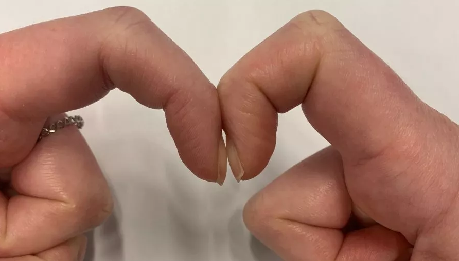 Capture 4 Ce simple test des doigts pourrait révéler des signes de cancer du poumon et d'autres problèmes de santé