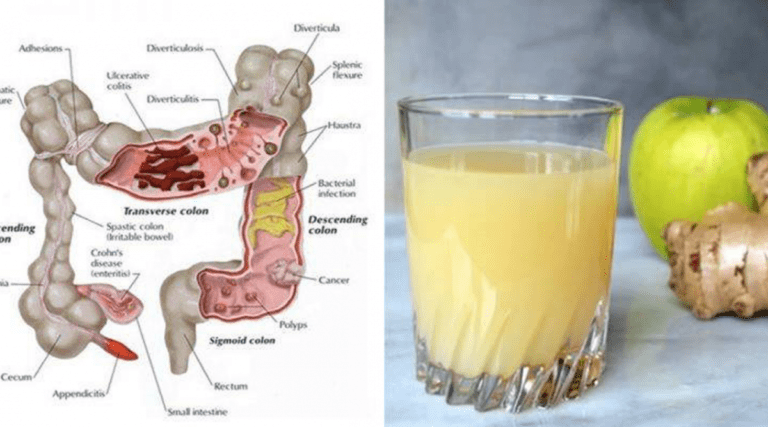 Debarrassez vous de 5 kilos de dechets de votre colon avec ce jus 1 1200x667 1