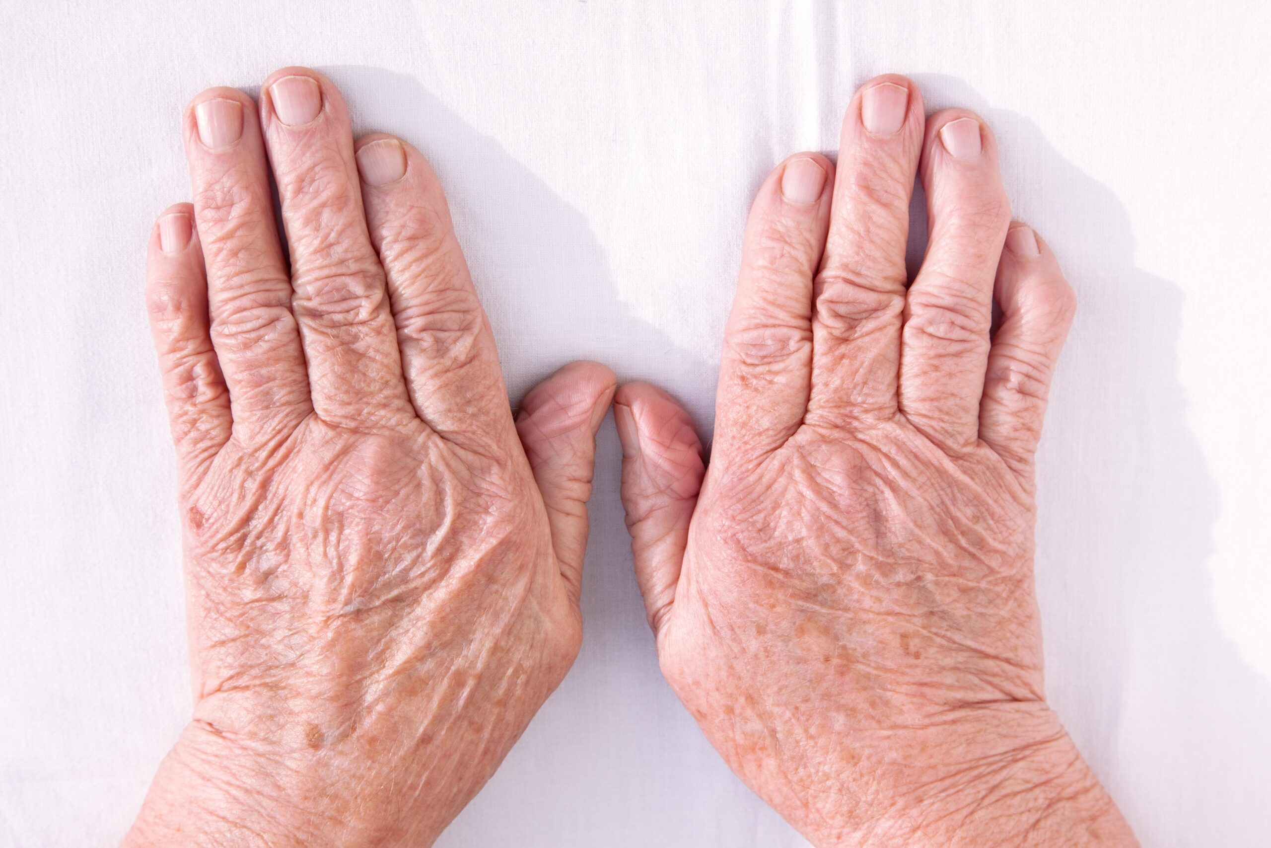 arthritic hands scaled Comment votre santé dentaire peut avoir un impact sur les autres organes du corps