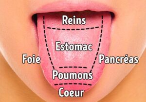 9 façons de se débarrasser de la langue blanche et de la rendre plus saine