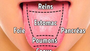 9 façons de se débarrasser de la langue blanche et de la rendre plus saine