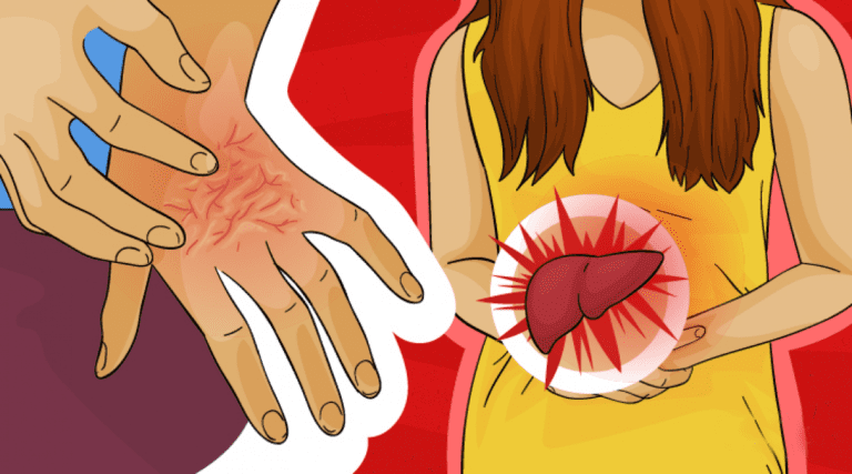 raisons pour lesquelles vous pourriez avoir souvent des demangeaisons 1 1 1200x667 1