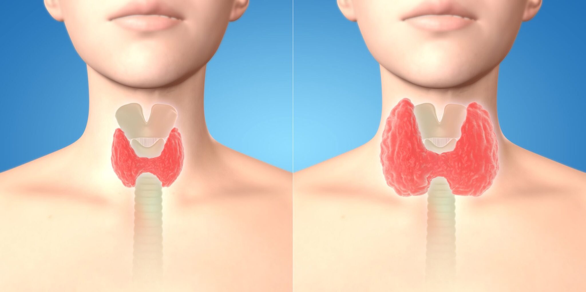 Mal De Gorge Persistant Et Thyroide 10 signes que vous souffrez d’un problème de thyroïde et voici les