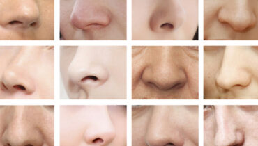 La forme de votre nez peut en dire long sur votre personnalité…