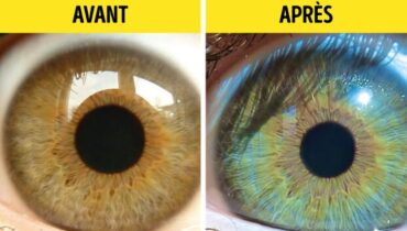 5 raisons qui peuvent faire changer la couleur de vos yeux