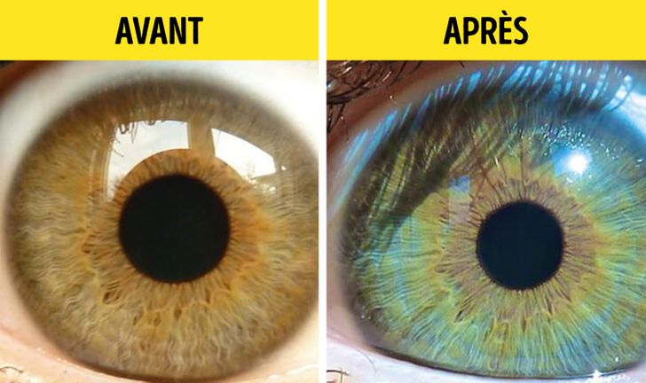 5 raisons qui peuvent faire changer la couleur de vos yeux2