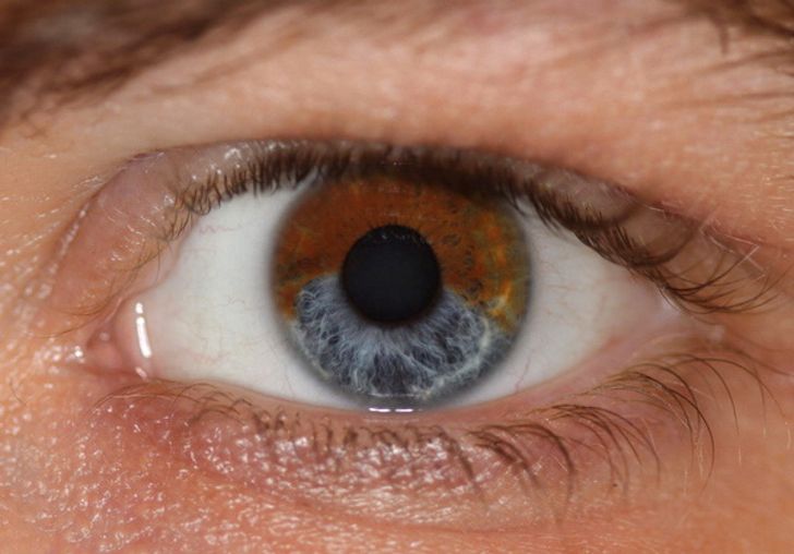 5 raisons qui peuvent faire changer la couleur de vos 5 raisons qui peuvent faire changer la couleur de vos yeux