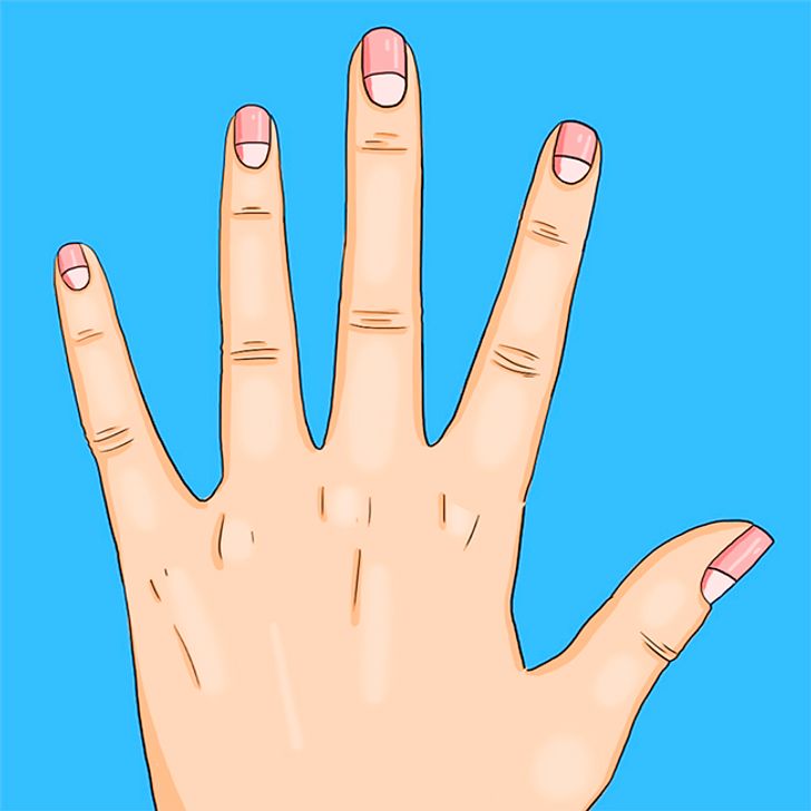 lunules de vos ongles2 6 Problèmes de santé que les lunules de vos ongles peuvent vous signaler