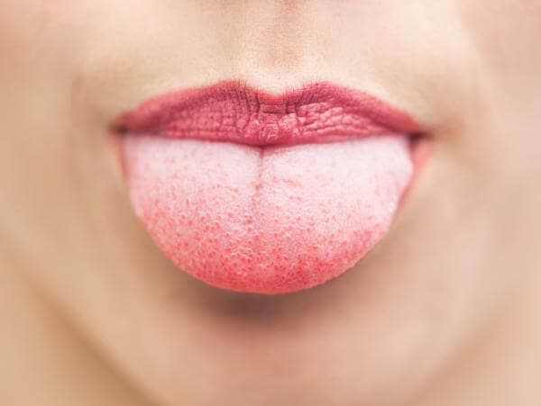6 choses que votre langue peut reveler sur votre etat sante 1 6 choses que votre langue peut révéler sur votre état santé