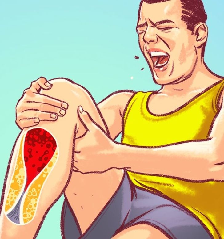 7 signes dangereux darteres bouchees que les gens ignorent souvent 7 signes dangereux d'artères bouchées que les gens ignorent souvent