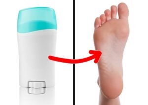 8 secrets pour se débarrasser des pieds malodorants en 1 semaine !