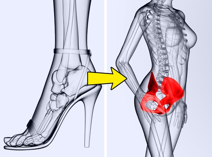 Voici ce qui arrive a votre corps si vous portez des talons hauts tous les jours 4 Voici ce qui arrive à votre corps si vous portez des talons hauts tous les jours