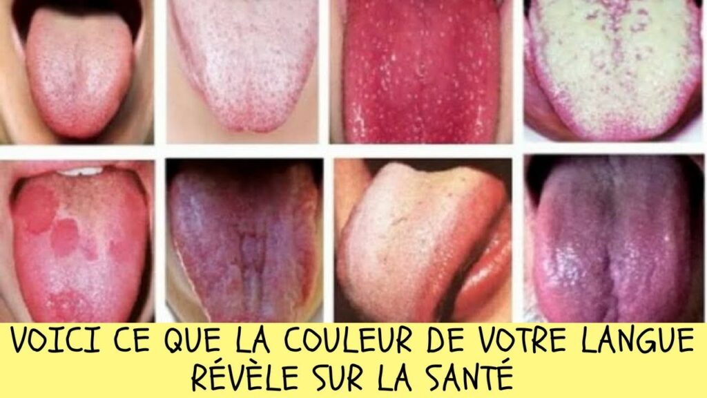6 choses que votre langue peut révéler sur votre état santé Être Heureux