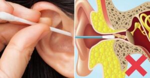 Ce que vous devez savoir sur le cérumen et comment nettoyer vos oreilles en toute sécurité