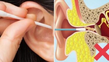 Ce que vous devez savoir sur le cérumen et comment nettoyer vos oreilles en toute sécurité