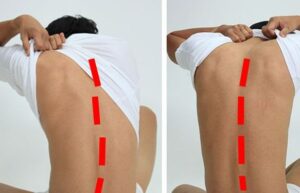 10 façons de se débarrasser définitivement du mal de dos