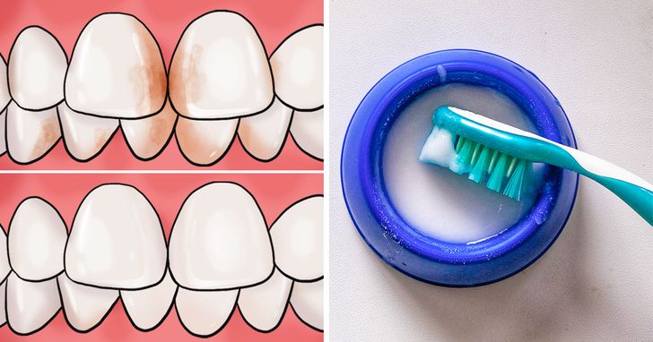 8 facons deliminer les taches de tartre de vos dents 8 façons d'éliminer les taches de tartre de vos dents