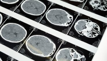 Une étude terrifiante révèle qu’après la mort, notre cerveau sait que l’on est décédé