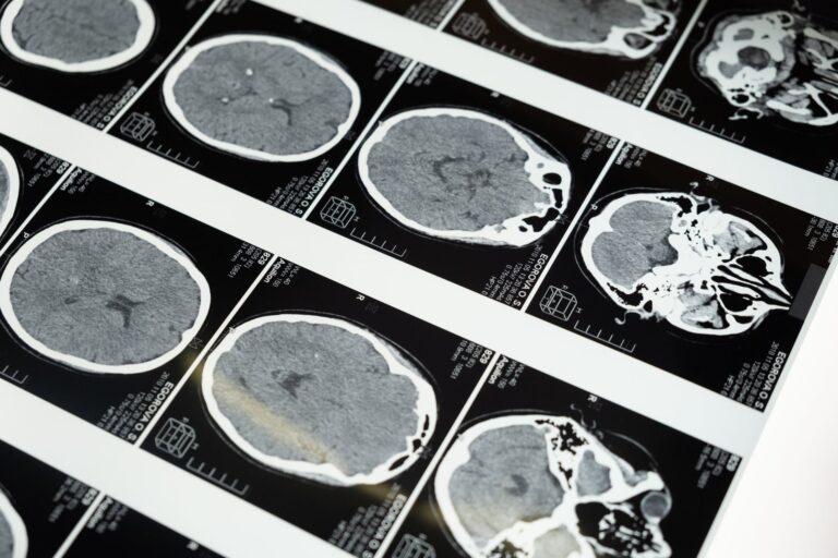 Une etude terrifiante revele quapres la mort notre cerveau sait que lon est decede 2