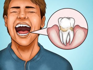 4 signes qui montrent que vous vous brossez les dents trop fort !