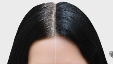 cheveux blancs remède