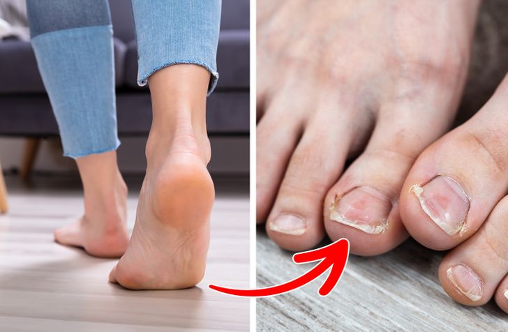 pieds nus exposés aux bactéries