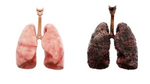 8 conseils pour nettoyer naturellement vos poumons et éviter les maladies