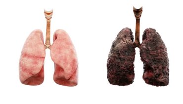 8 conseils pour nettoyer naturellement vos poumons et éviter les maladies