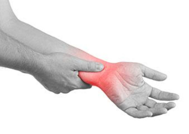tenosynovite Qu'est-ce qu'une inflammation de la gaine du tendon ?