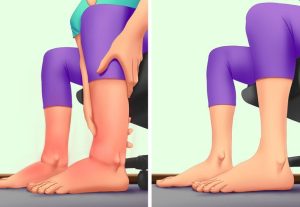 8 conseils pour les jambes gonflées pour lesquels votre corps vous remerciera