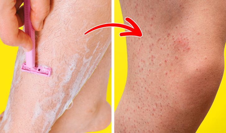 Rasage ou epilation a la cire Rasage ou épilation à la cire : Qu'est-ce qui est le mieux pour votre peau ?