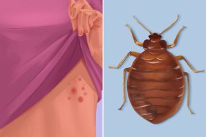 8 signes qui indiquent que des insectes se sont installés dans votre maison