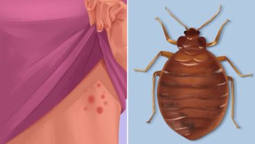 8 signes qui indiquent que des insectes se sont installés dans votre maison