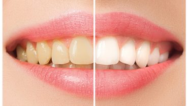 dents blanches et saines
