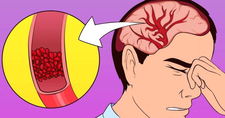 Les maux de tête, la fatigue, l'insomnie