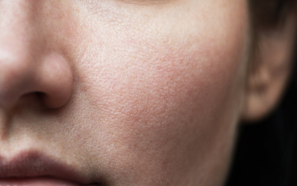 Tenter de resserrer les pores à l'aide de sérums spéciaux