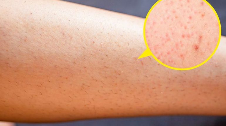 4 effets sur votre corps si vous arrêtez de vous épiler 4 effets sur votre corps complètement Conserver crème ou de gel démangeaisons des irritations et des coupures douche émoussée endommager épilation épilation à la cire erreurs à éviter erreurs à éviter absolument lors du rasage qui risquent d’abîmer votre peau éviter les irritations Exfolie la peau feu du rasoir fréquence d'utilisation grand inconvénients du rasage infections cutanées inverse irritations et des coupures jambes l'intérieur des lames la salle de bain lame émoussée lames les lames les rasoirs pour femmes mieux nombre de lames peau douce peau lisse poils poils incarnés rasage Rasage ou épilation à la cire rasoir rasoirs risques d'irritation se couper rasoir sens inverse souples stockez Tête un rasoir pour femmes vous arrêtez de vous épiler