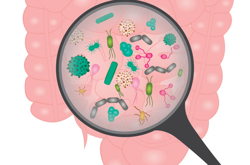 proliferation bacterienne dans lintestin grele 10 complications possibles de la maladie de Crohn